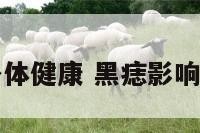 黑痣影响身体健康 黑痣影响身体健康吗