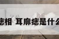 耳廓痣相 耳廓痣是什么意思