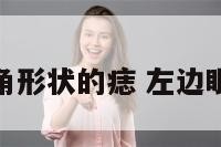 左眼角有三角形状的痣 左边眼角有三颗痣