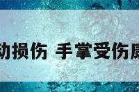 手掌运动损伤 手掌受伤康复训练