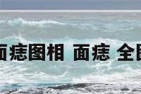 面痣图相 面痣 全图