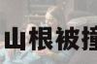 山根撞到运势 山根被撞断裂怎么破解