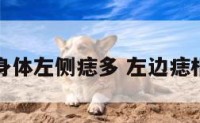 身体左侧痣多 左边痣相