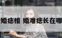 结婚痣相 婚难痣长在哪里