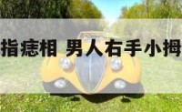 男右手小拇指痣相 男人右手小拇指有痣代表什么