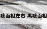 黑痣面相左右 黑痣面相说