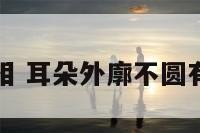 耳朵不圆面相 耳朵外廓不圆有什么影响吗