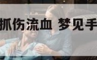 梦到手被动物抓伤流血 梦见手被动物抓破流血了